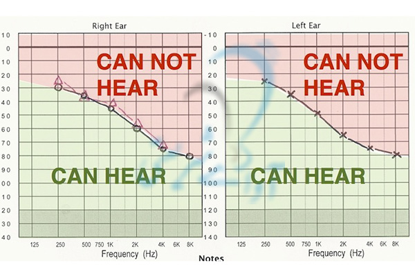 دستگاه سنجش شنوایی کلینیک آوای شریعتی 
