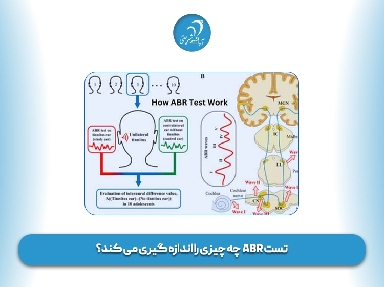  تست ABR  چه چیزی را اندازه گیری می کند؟