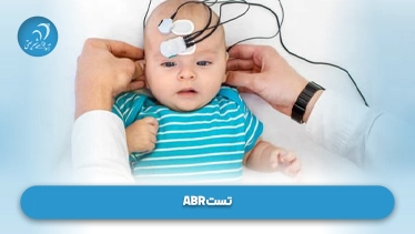 تست ABR