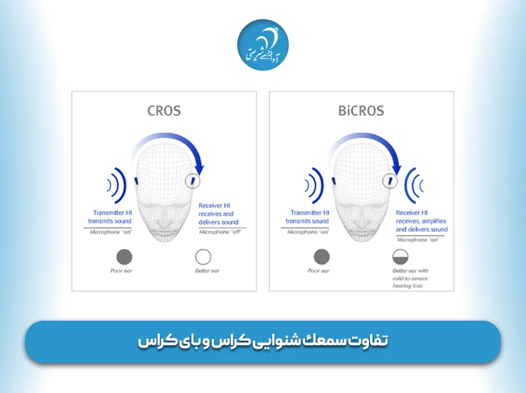 تفاوت سمعك شنوایی کراس و بای‌ کراس