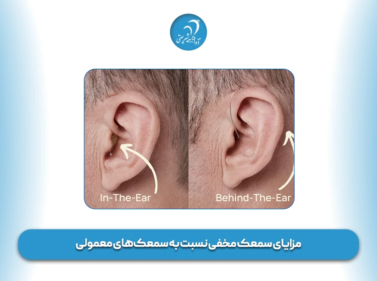 مزایای سمعک مخفی نسبت به سمعک‌های معمولی
