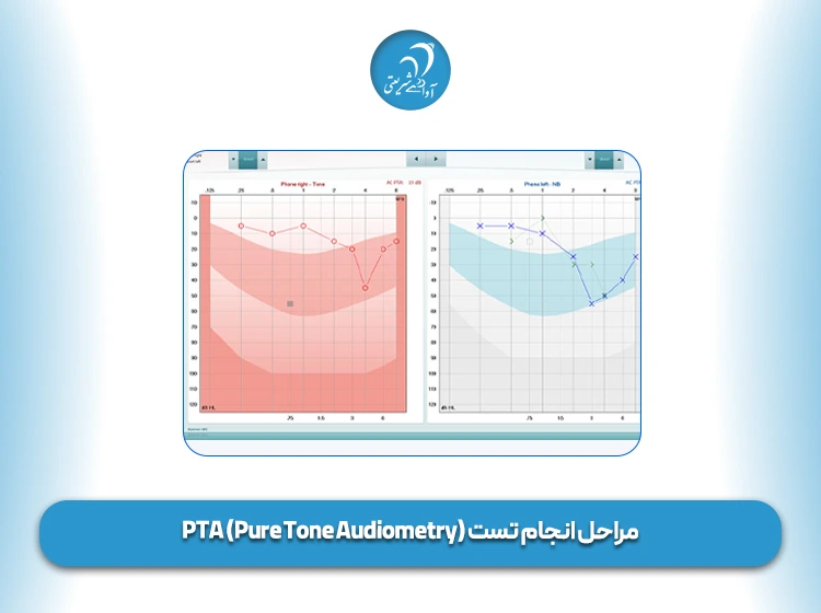 مراحل انجام تست PTA (Pure Tone Audiometry)