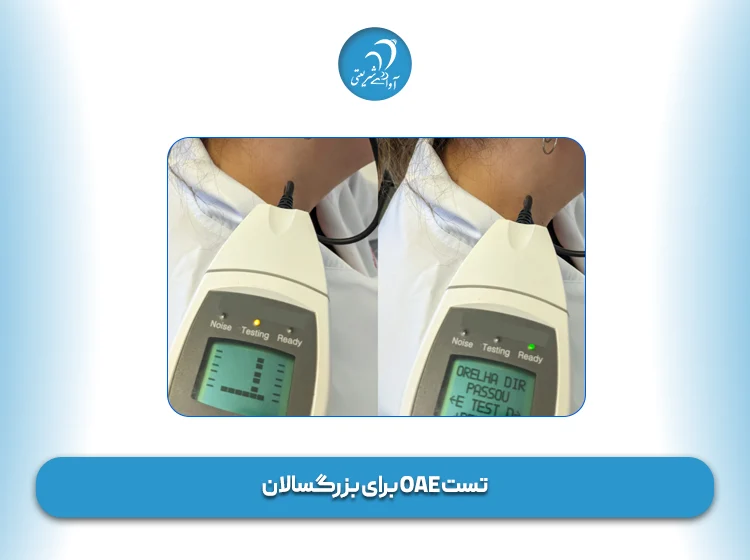 تست OAE برای بزرگسالان