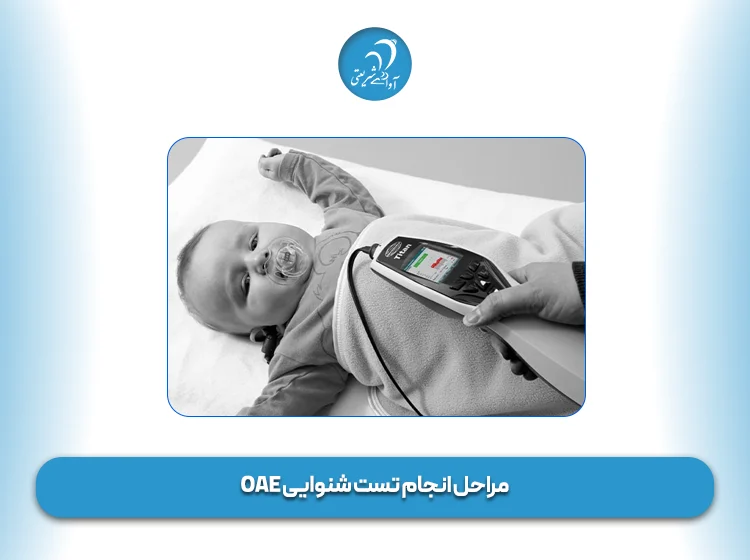 مراحل انجام تست شنوایی OAE