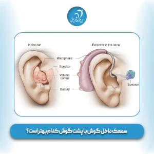 سمعک داخل گوش یا پشت گوش کدام بهتر است؟