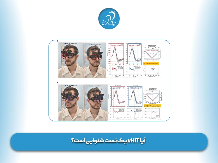 آیا vHIT یک تست شنوایی است؟