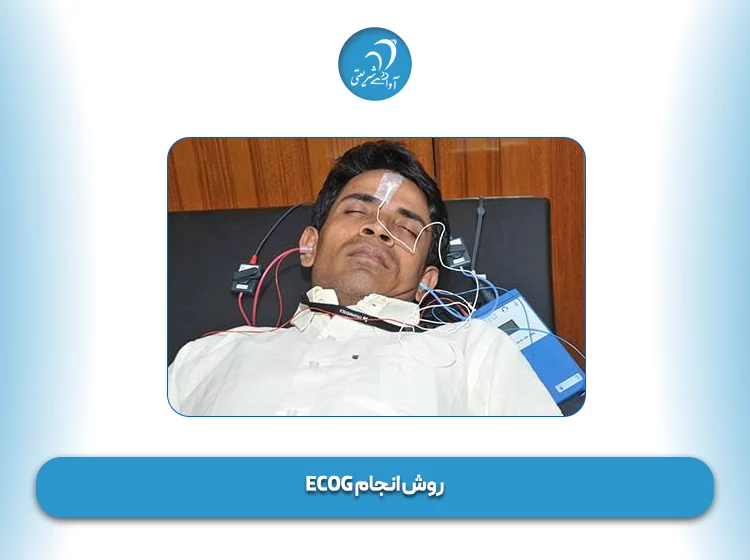 روش انجام ECOG